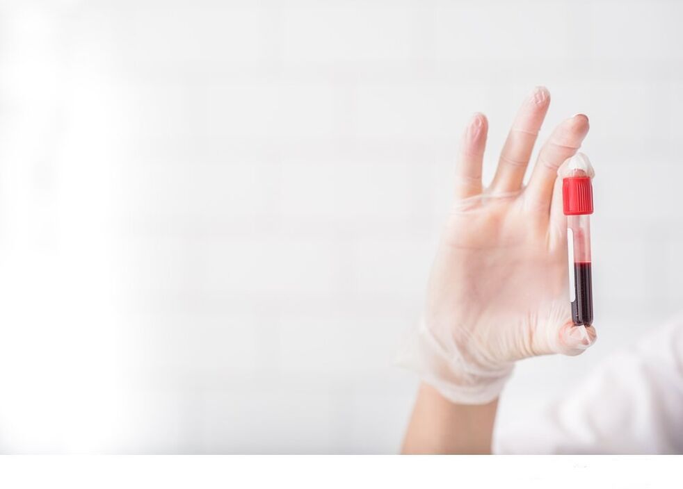 аналіз крові на гельмінтів