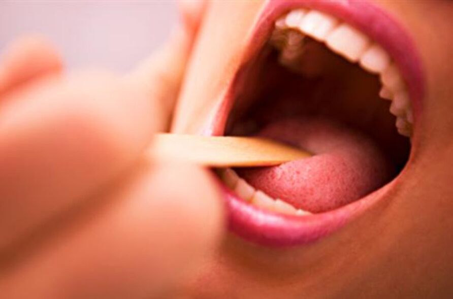 види паразитів у роті людини